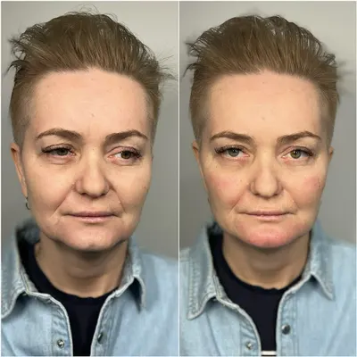 Słomka Medycyna Estetyczna